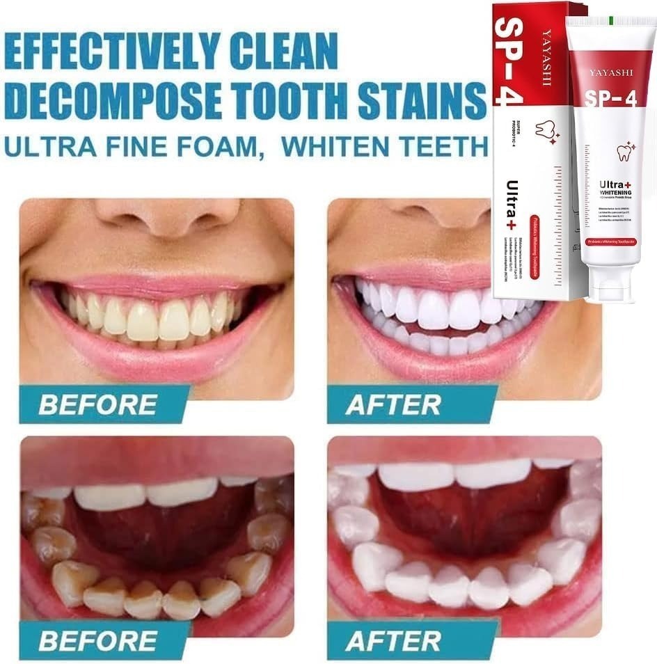 yayashi sp-4 ultra whitening toothpaste